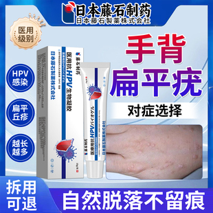 手背扁平疣专用去除膏一抹灵神祛疣瘊小肉粒器抗HPV药房同售JV
