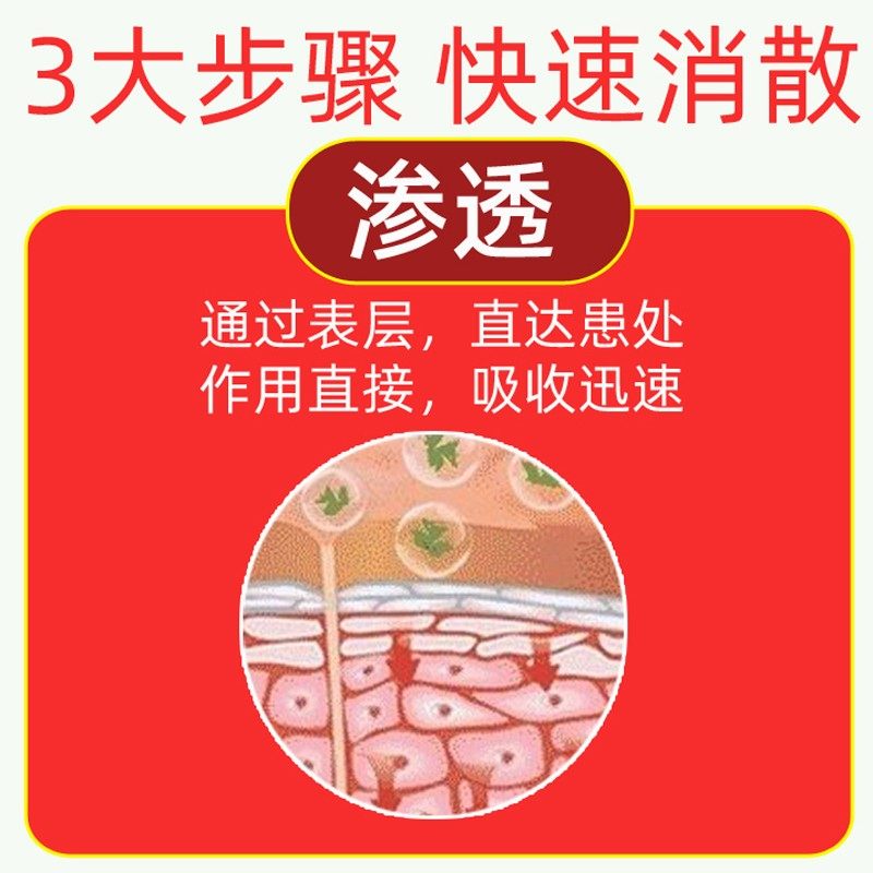 甲状腺结节消贴散结专用甲状腺膏颈部粗大甲亢脖子囊肿疼痛桥本氏
