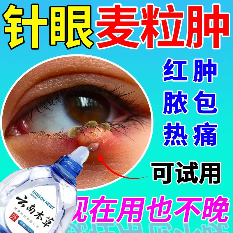 金霉素眼药水眼睛长麦粒肿细菌性结膜炎眼睑炎角膜炎眼药水消炎
