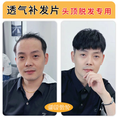 新品假发男短f发毛寸全真发无痕隐形假发片男士可粘可卡轻薄头顶