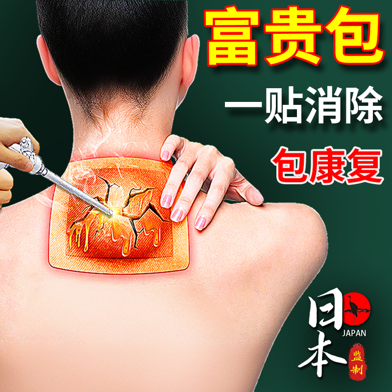 富贵包消除效特药去除颈椎病富贵包消除贴正品专用热敷膏疏通神器