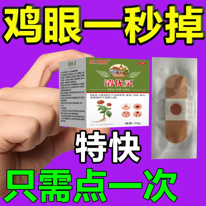鸡眼膏根去贴除医用级正品官方旗舰店专用的药神器祛疣去老茧无痛