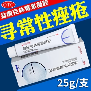 盒寻常性痤疮正品 1支 保障XJ 盐酸克林霉素凝胶25g 金日