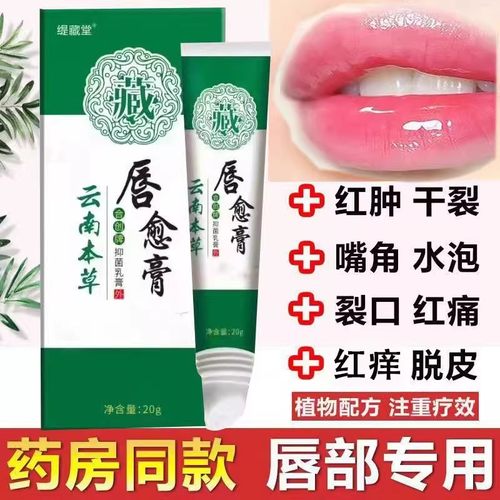 云南本草唇炎防裂润唇膏嘴唇干裂