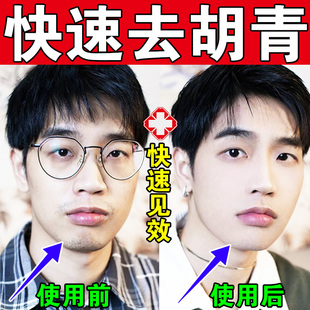 胡青去除男士去胡青淡化男士胡子黑印络腮胡胡茬唇毛胡茬刮完护理