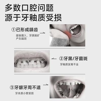 儿童牙膏3-6一12-14岁含氟宝宝防蛀换牙期再生硅护牙龋齿修复正品