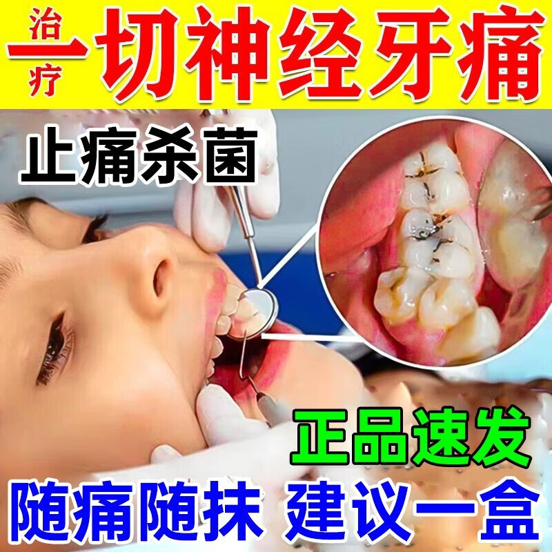 丁鹏乳膏旗舰店杀死牙神经去牙疼牙痛立可停治蛀牙虫牙牙龈红肿