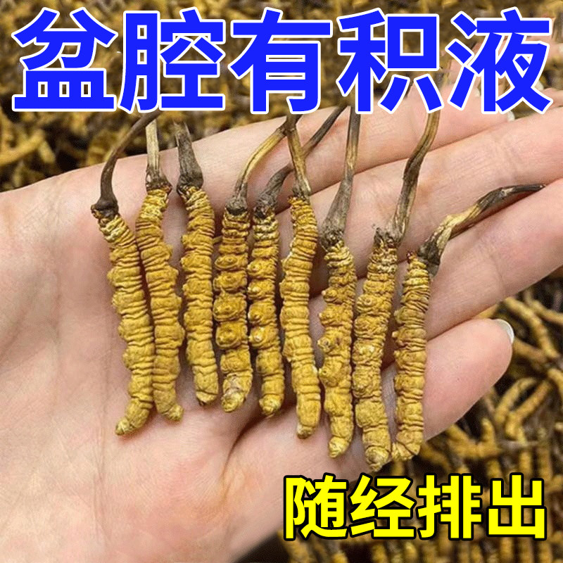 现货速发盆腔贴内裤发黄积液小腹腰骶疼背疼痛坠胀热敷慢性输卵堵