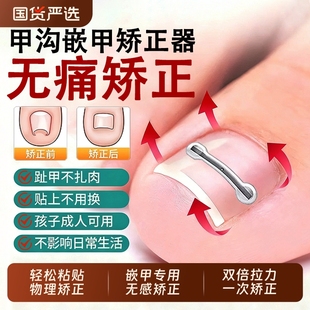 甲沟嵌甲矫正器仿生骨贴脚趾甲盖内嵌神器足科专用修脚刀无感矫正