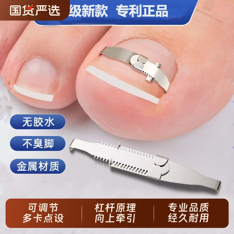 甲沟矫正器嵌甲矫正器脚趾甲卷指甲扎肉纠正神器正甲扣炎正甲贴片