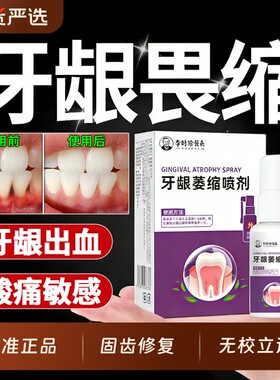 【正品保障】牙龈萎缩喷剂