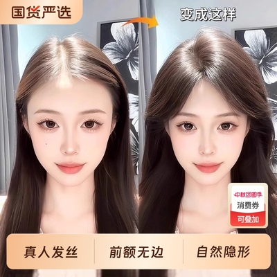 假发女片头顶高颅顶真发自然前额增发量发际线遮发缝蓬松八字刘海