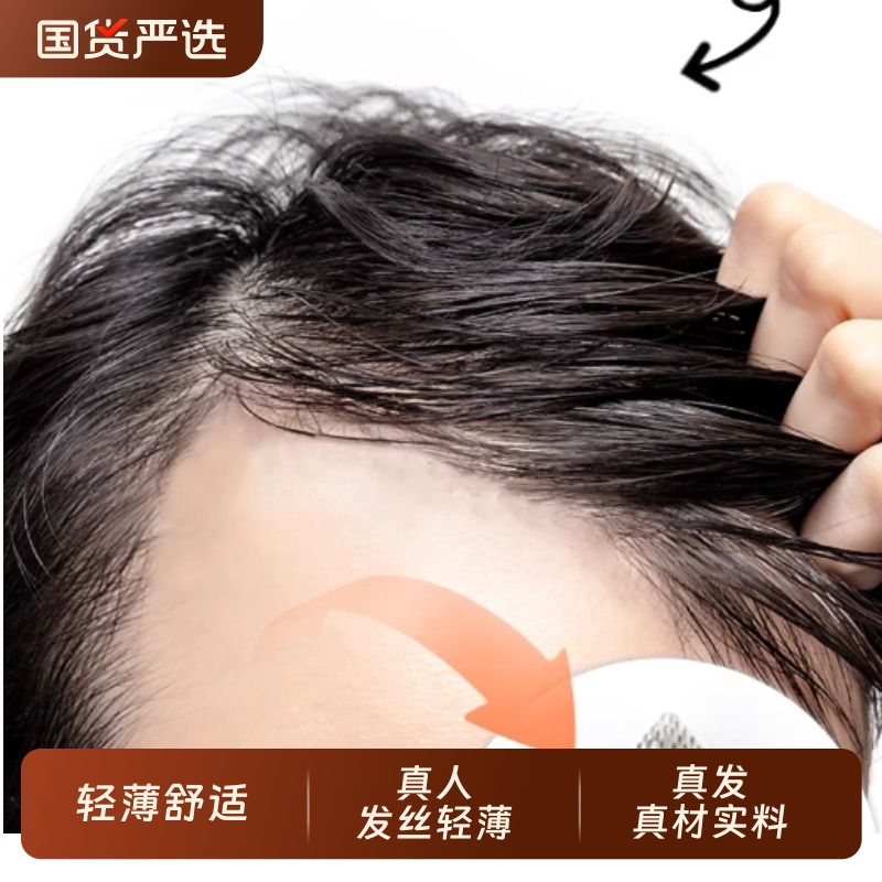 男士发际线贴遮盖秃斑脱发秃顶