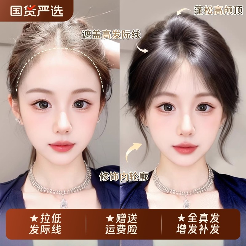 假发女胎毛刘海头顶补发增发自然前额全真发隐形轻薄发际线遮白发