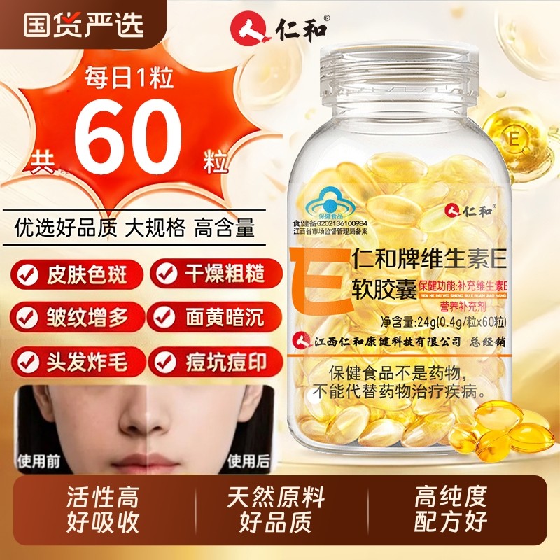 仁和维生素E软胶囊ve维e面部外涂油内服天然正品官方旗舰店美容,保健食品/膳食营养补充食品,维生素/复合维生素,淘宝优惠券,粉丝福利购,淘宝优惠卷