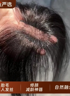 刘海假发女片头顶遮神器高颅顶蓬松真发无痕发际线贴前额隐形胎毛