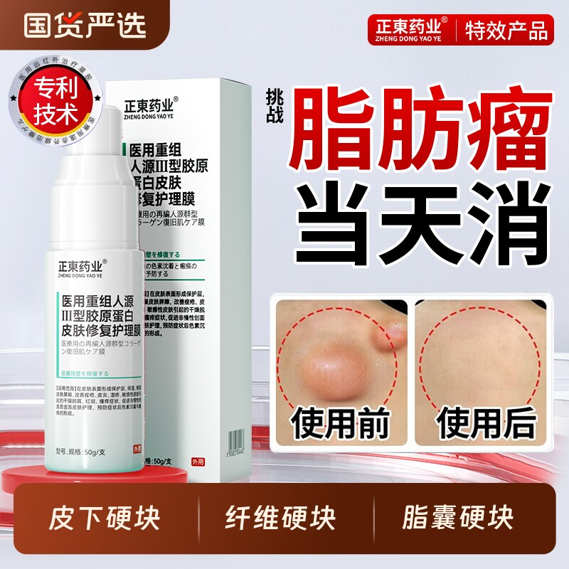 医用远红外治疗凝胶脂肪瘤包消除膏去除纤维皮脂腺囊肿硬肿块结节