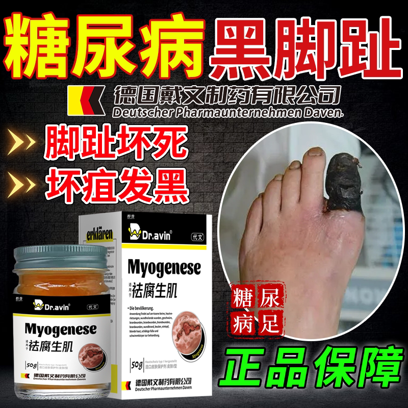 糖尿病烂足黑脚趾专快速用搭配药膏脚趾坏死坏疽发黑供血不足xq