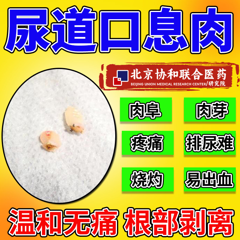 尿道口息肉阜长肉芽尿路感染的消炎药瘙痒发炎阴道口小疙瘩灼热xq