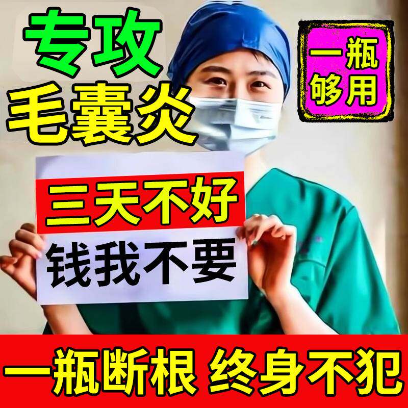 现货速发头痒有疙瘩毛襄炎去头屑除螨头皮药头部脂溢性皮