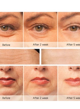 极速Electric Eye Beauty Device Eye Anti-AgeingQ Massage Stic