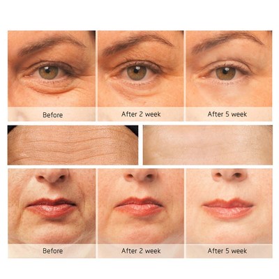 极速Electric Eye Beauty Device Eye Anti-AgeingQ Massage Stic