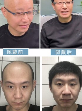 速发假发男全头套式中老年短发遮盖白发光头真发逼真自然男士假发