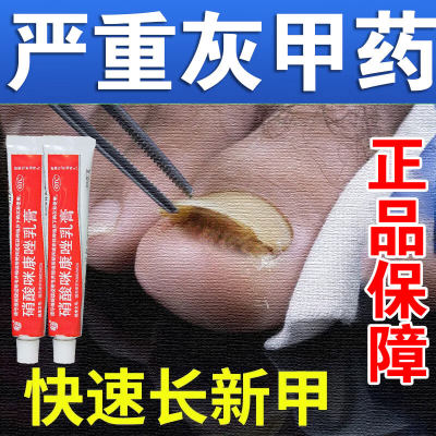 【扬子洲】硝酸咪康唑乳膏2%*20g*1支/盒