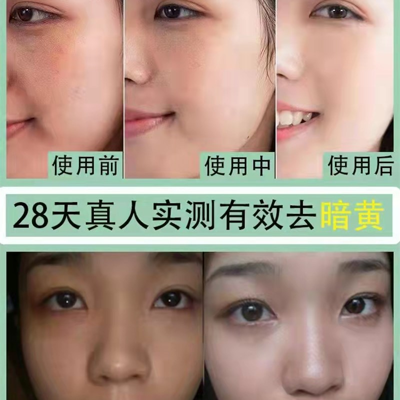 速发去黄气提亮肤色美白脸色暗黄改善暗沉精华液皮肤熬夜发黄护肤