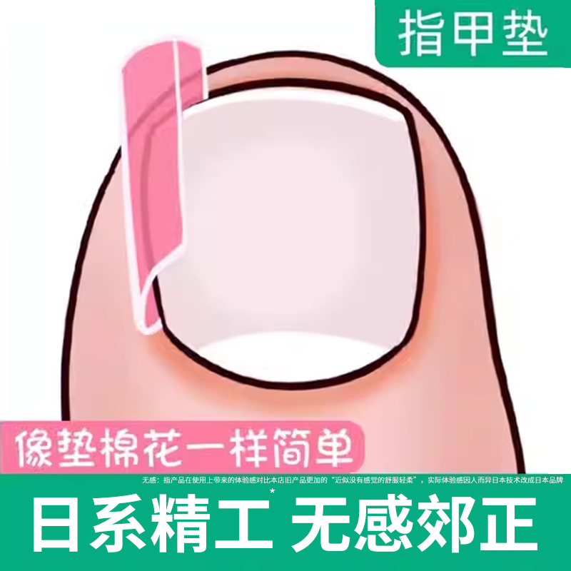 嵌甲纠正就用它！嵌甲矫正器