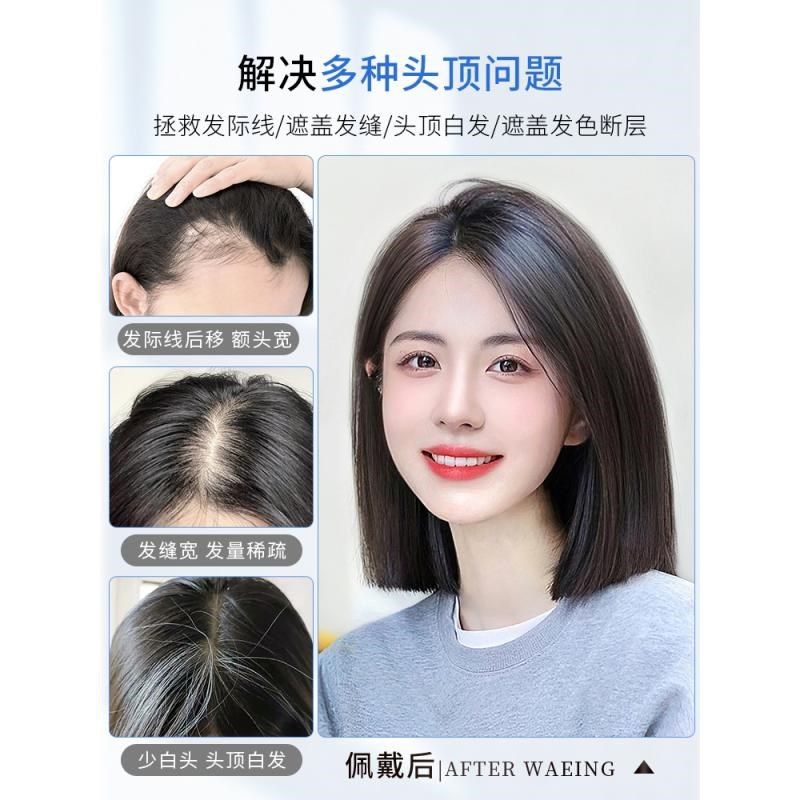 速发假发片补头顶发发真片款薄遮白人秃盖顶的神器发发头发补发接