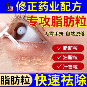 修正去除脂肪粒神器眼部汗管瘤专用眼角眼周油脂粒眼霜男女士正品