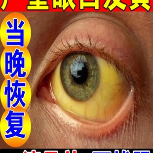 极速【一滴去黄】眼白发黄清澈去黄混浊眼睛黄R斑病变眼水滴眼液