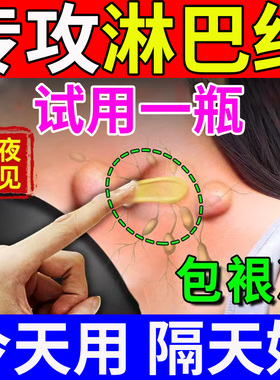 极速淋巴膏颈g部通络淋巴结节肿大散结贴膏去淋巴结副乳消除膏疏