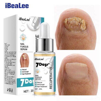极速iBeaLee 7DAYS Repair Nail FunguFs Treatments Essence Foo