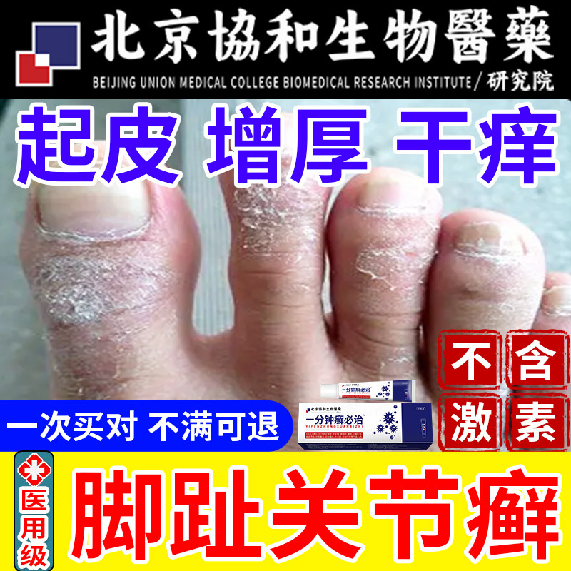 脚趾关节癣脚关节长湿疹脚指干痒脚气角化型真菌感染起皮增厚aq