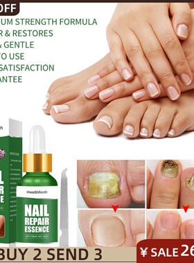 极速Nail Fungus Treatments wRepair Serum Feet Care Foot Fung