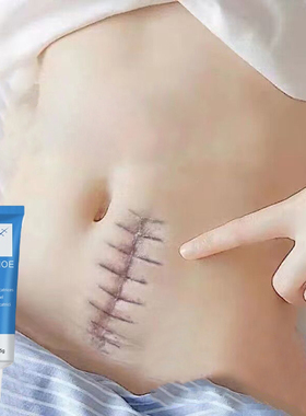 极速Cicatriz que remove o gel Apara remover manchas da cicat