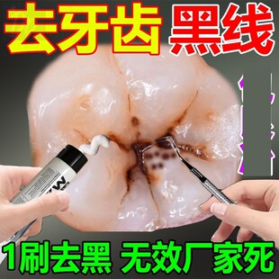 去牙齿黑线去除黑牙洗牙神器牙渍垢黄一擦即除去黄去口臭美白牙膏