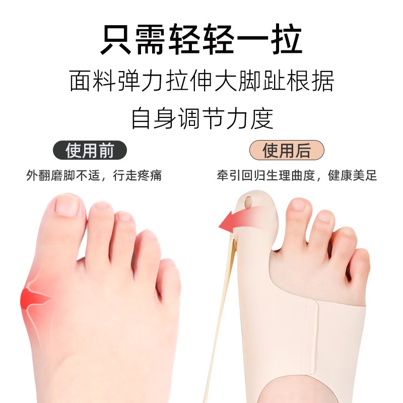 热销大拇指外翻矫正器脚趾分离器可以F穿鞋分趾袜大脚骨突出可调