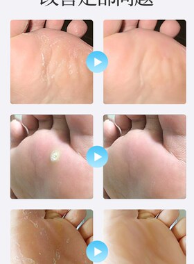 极速工具套e组磨脚板去角皮角皮清手脚起皮祛脚上死皮修脚器脚跟