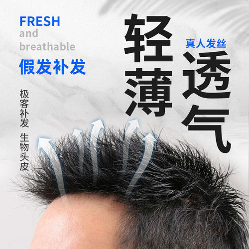 极速极客补发h假发男生物头皮秃顶头顶补发男短发隐形无痕透气假