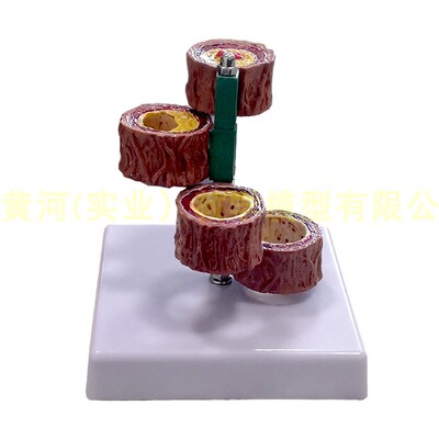 极速血栓人体支脉/粥样/t血管模型 硬化 心血管动脉模型 心内科教