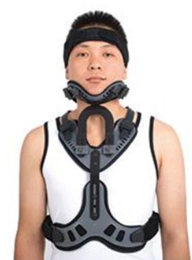 极速可调式头颈胸H固定器支具术后