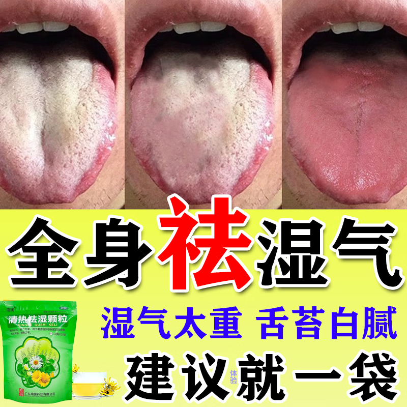 【众生】清热祛湿颗粒10g*16袋/包