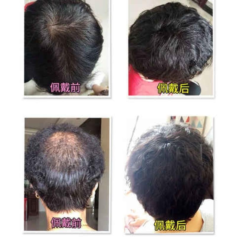 极速时尚假发片头顶补发卷发真人发丝F刘海遮白发假发片头顶补发