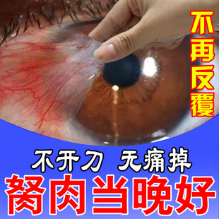 极速去除眼睛胬肉肉疙瘩异物感眼睛干痒看不清肿胀痛.专用护眼贴