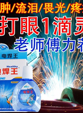 电焊眼药水氩弧伤闪打烧王宝工专