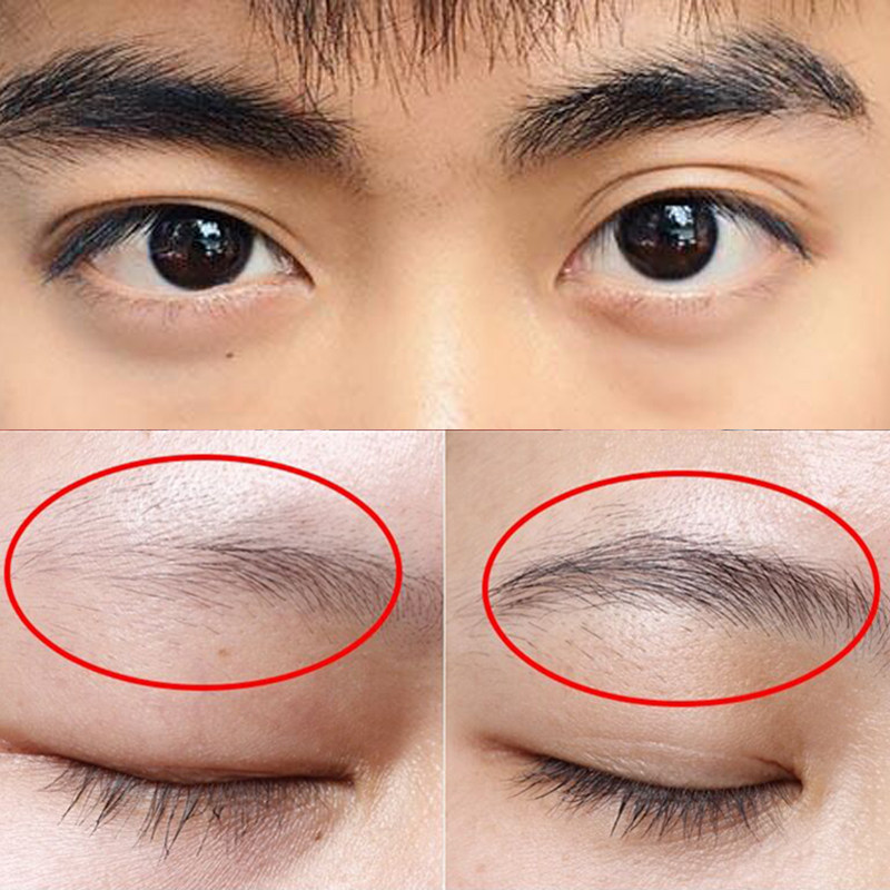 【更适合黄种人的生眉液】男士眉毛变浓变黑 解决眉毛稀疏问题