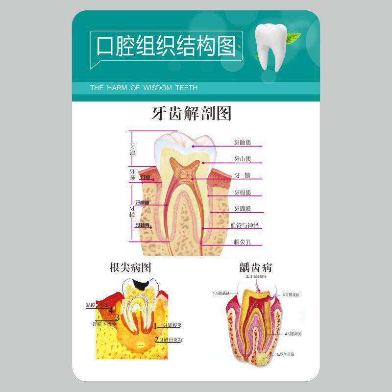 亚克力口腔组织结构图海报牙科挂图上墙定制做
